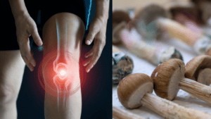 An inflamed knee side by side an image of magic mushrooms
